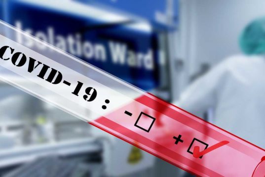 U Srbiji koronavirus odneo još jednu žrtvu, zaražene još 74 osobe Korona virus